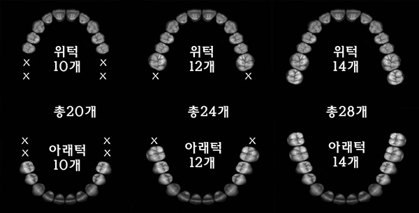사진1= 한국인은 위아래 큰어금니가 2개씩 맞물려야 정상적인 식사를 할 수 있다.